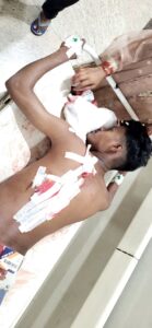 कपाली: ईद की खुशियों के बीच खूनी संघर्ष, ताज नगर में युवक पर चाकू से जानलेवा हमला, हालत गंभीर