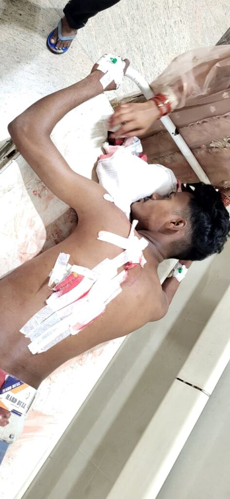 कपाली: ईद की खुशियों के बीच खूनी संघर्ष, ताज नगर में युवक पर चाकू से जानलेवा हमला, हालत गंभीर