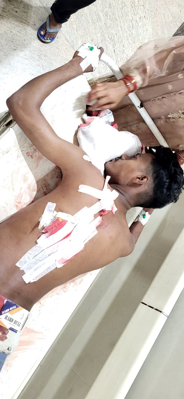 कपाली: ईद की खुशियों के बीच खूनी संघर्ष, ताज नगर में युवक पर चाकू से जानलेवा हमला, हालत गंभीर