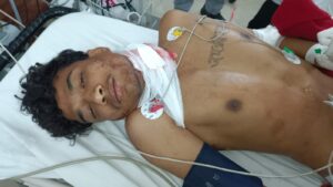 जमशेदपुर: टेल्को थीम पार्क के पास ‘चापड़बाजी’ से सनसनी; एकतरफा प्रेम में युवक पर जानलेवा हमला, प्रेमिका पर ही लगा उकसाने का आरोप