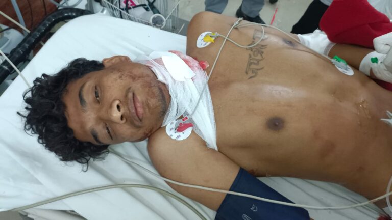 जमशेदपुर: टेल्को थीम पार्क के पास ‘चापड़बाजी’ से सनसनी; एकतरफा प्रेम में युवक पर जानलेवा हमला, प्रेमिका पर ही लगा उकसाने का आरोप