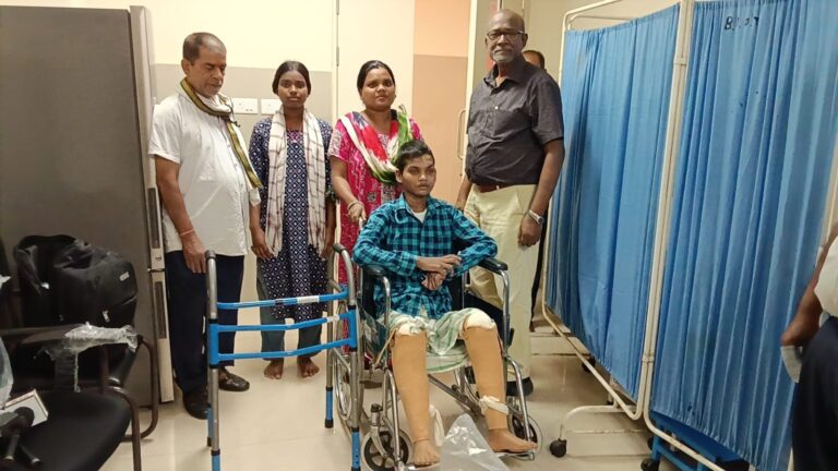 जमशेदपुर : 33 हज़ार वोल्ट के करंट से झुलसा बालक 8 महीने बाद पैरों पर खड़ा हुआ; डॉक्टरों ने कृत्रिम अंगों से दी नई जिंदगी