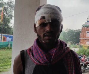 जमशेदपुर में ट्रक चालक पर जानलेवा हमला, लूटपाट का प्रयास विफल; हथियारबंद बदमाश फरार