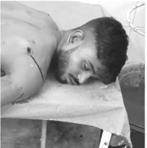 आदित्यपुर में युवक पर धारदार हथियार से हमला, आरोपी पिंटू प्रधान गिरफ्तार