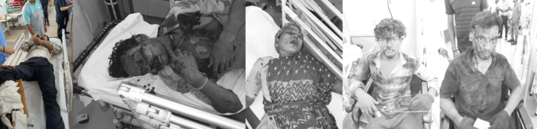 आदित्यपुर की फैक्ट्री में भीषण विस्फोट, 5 मजदूर गंभीर रूप से झुलसे; तीन की हालत नाजुक