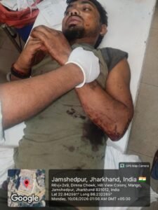 आदित्यपुर : रेलवे ट्रैक पार करते समय मालगाड़ी की चपेट में आया युवक, हालत नाजुक