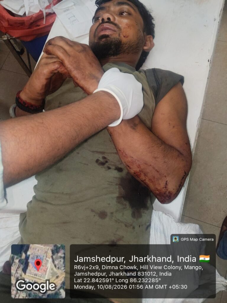 आदित्यपुर : रेलवे ट्रैक पार करते समय मालगाड़ी की चपेट में आया युवक, हालत नाजुक