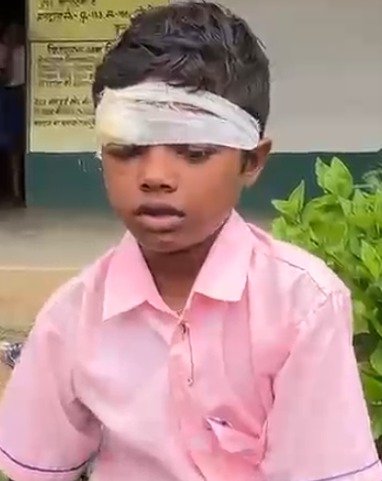 सरायकेला में प्रधानाध्यापक पर बच्चे को पीटकर सिर फोड़ने का आरोप, ग्रामीणों में आक्रोश; कार्रवाई की मांग