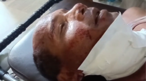 जमशेदपुर में प्रेम प्रसंग पर विवाद, महिला पर चाकू से हमला करने की कोशिश के बाद युवक ने खुद को किया घायल