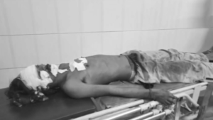 जमशेदपुर: युवक पर चापड़-चाकू और पत्थर से जानलेवा हमला, एमजीएम में चल रहा इलाज