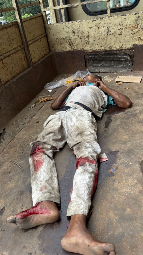 जमशेदपुर में दर्दनाक सड़क हादसा: तेज रफ्तार हाइवा की चपेट में आया बाइक सवार, दोनों पैर बुरी तरह जख्मी