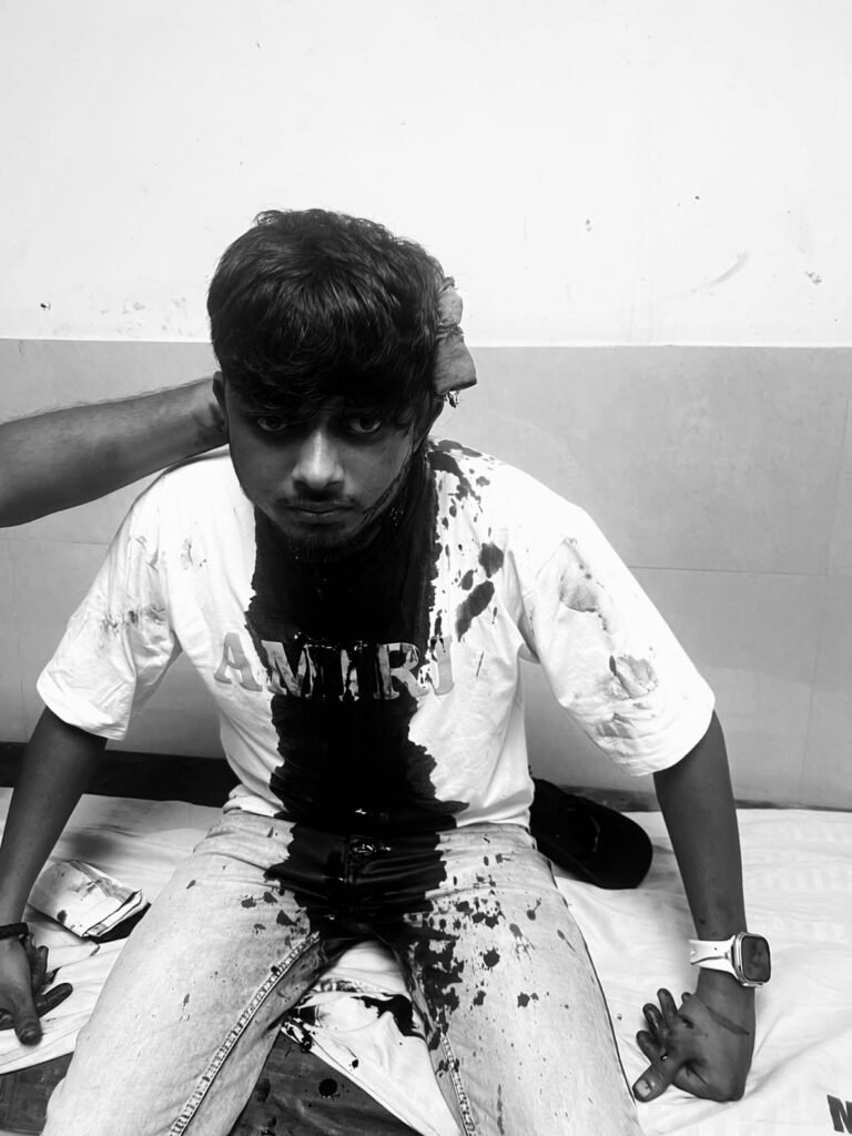 जमशेदपुर: कदमा के शास्त्री नगर में युवक पर चापड़ से हमला, एमजीएम में इलाजरत