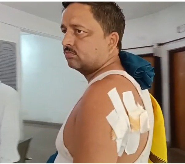 जमशेदपुर में राशन दुकानदार पर कुल्हाड़ी से जानलेवा हमला, चोरी के आरोपी को छोड़ने पर पुलिस पर उठे सवाल