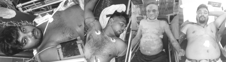 सोनारी के उडुपी रेस्टोरेंट में ताबड़तोड़ फायरिंग में चार घायल, टीएमएच में भर्ती