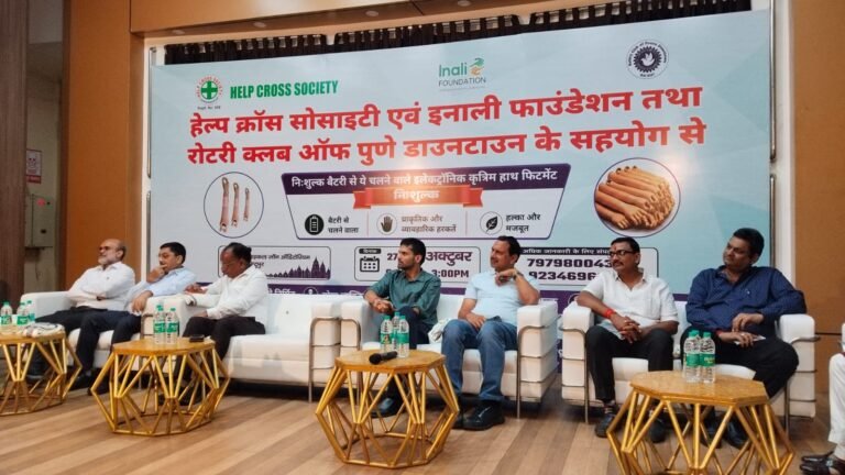 जमशेदपुर में दिव्यांगजनों को मिलेगी नई जिंदगी की उम्मीद, 70 लोगों को लगाए जाएंगे निःशुल्क कृत्रिम हाथ